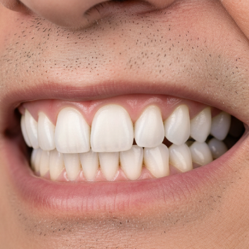 A strong, natural smile with renewed confidence and comfort.